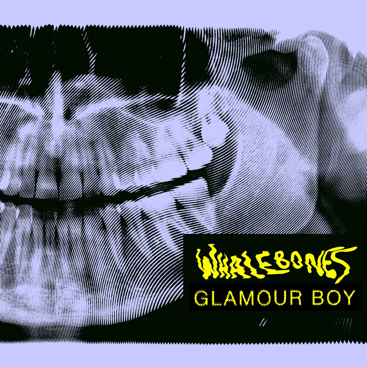 Cover art from GLAMOUR BOY by Whalebones
